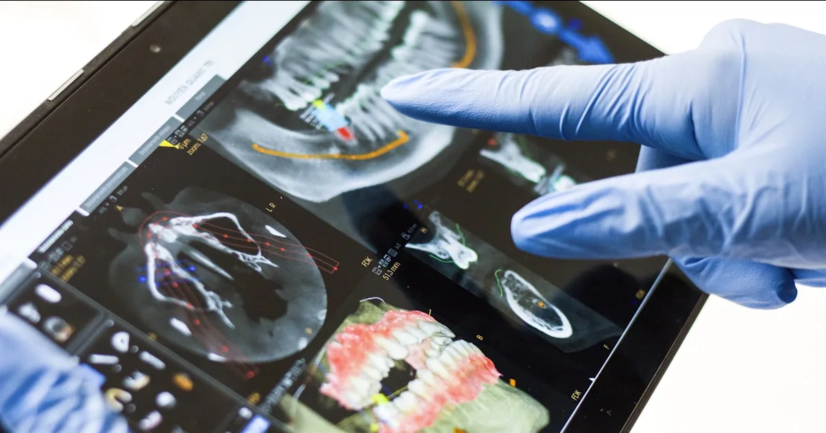Dentist in gloves reviewing a 3D dental scan and X-ray images on a tablet during treatment planning, serving Wellington and West Palm Beach, FL